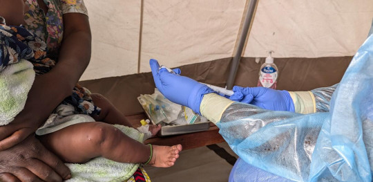 CH11144019 Christelle, 5 months, a Mpox Patient, Receives Medical Attention from Nurse Safari in DRC