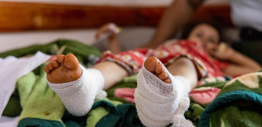 CH1705300 Eman 5 is treated for shrapnel wounds in Taiz Yemen