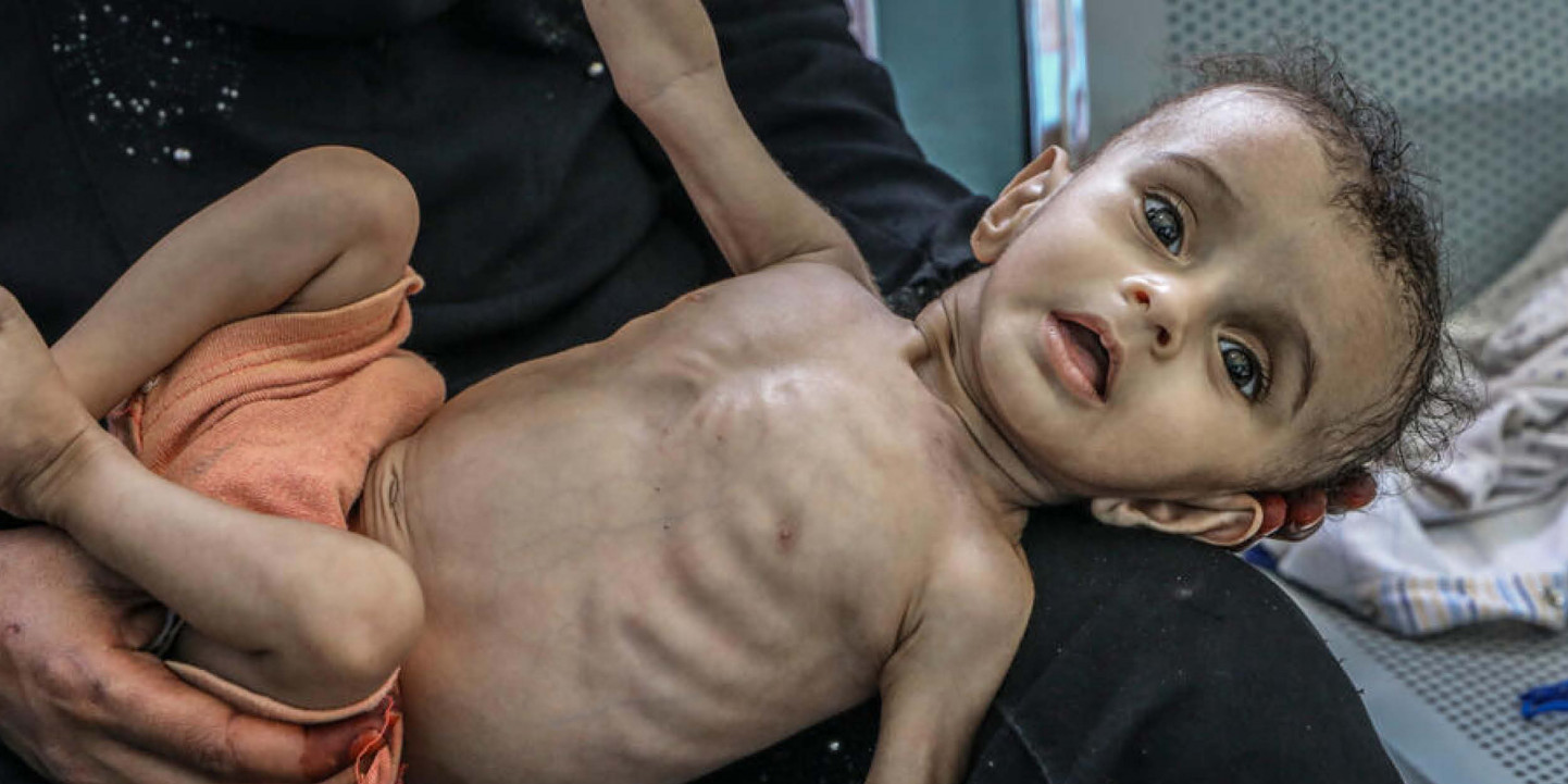 Donate to Yemen Food Crisis Appeal — Save the Children